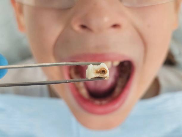 Best Pediatric Emergency Dentist in Wickliffe, OH